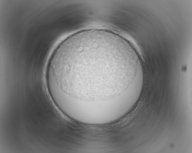 X0000116551472201001211151