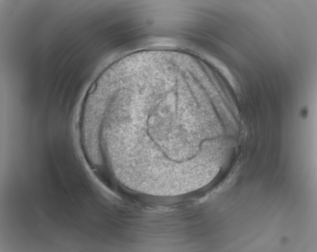 X0000116551475201001211151