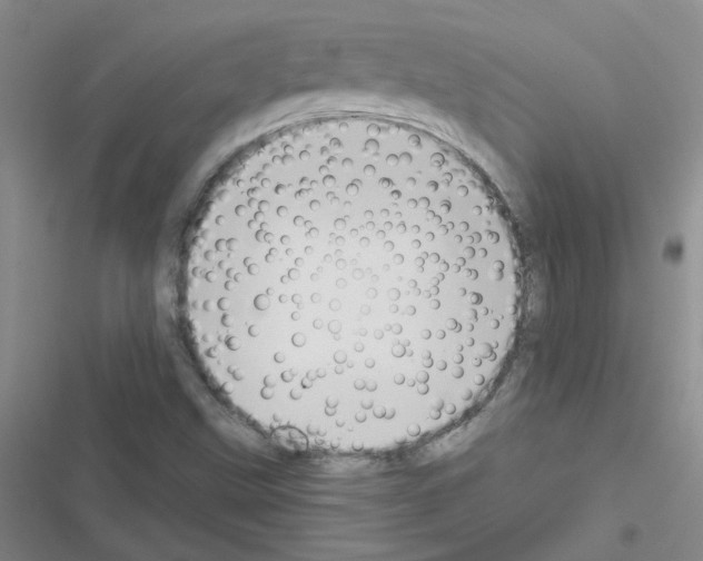 X0000116551499201001211151