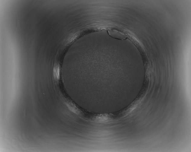 X0000116560076200912171418