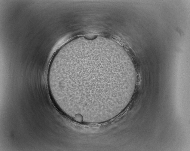 X0000116560004201001071144