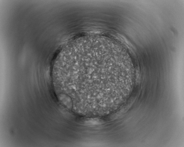 X0000116560377201001071140