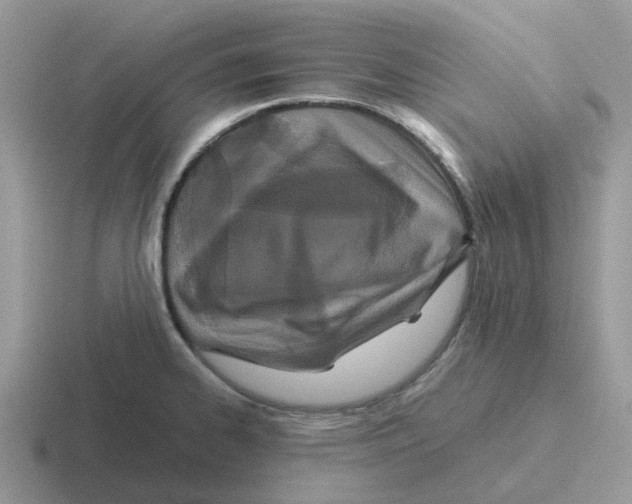 X0000116561334201001071128