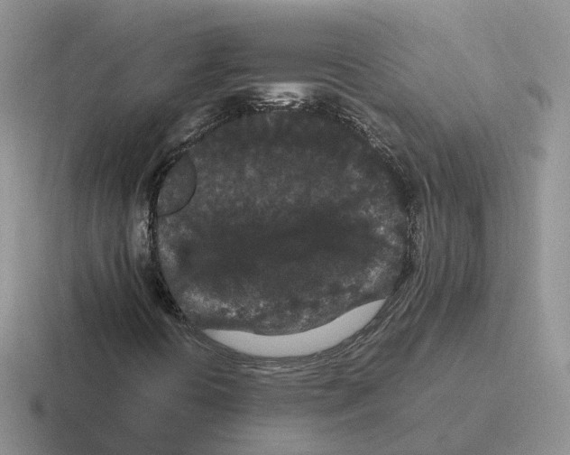X0000116561394201001071126