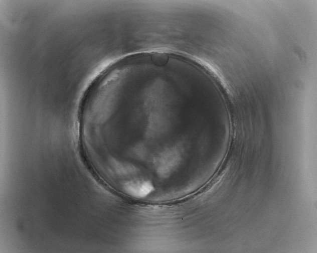X0000116561414201001071126