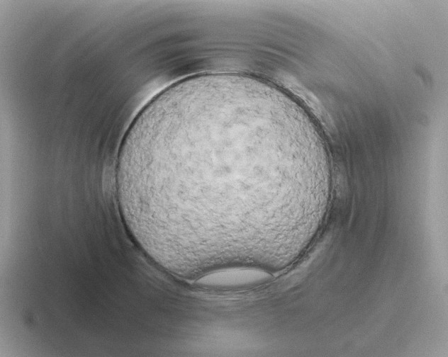X0000116561473201001071126