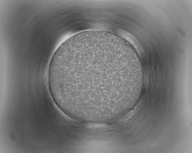 X0000116561487201001071125