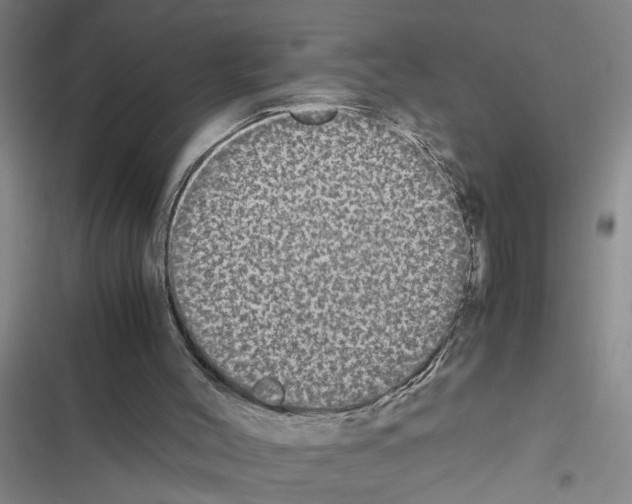 X0000116560004201001211232
