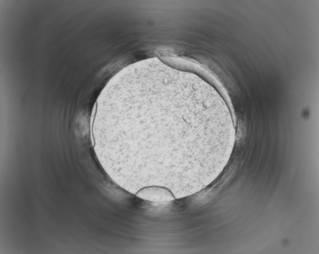 X0000116560478201001211226