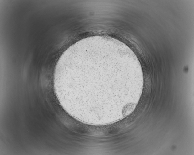 X0000116560499201001211226
