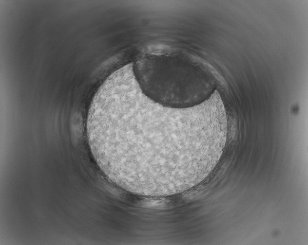X0000116560569201001211225