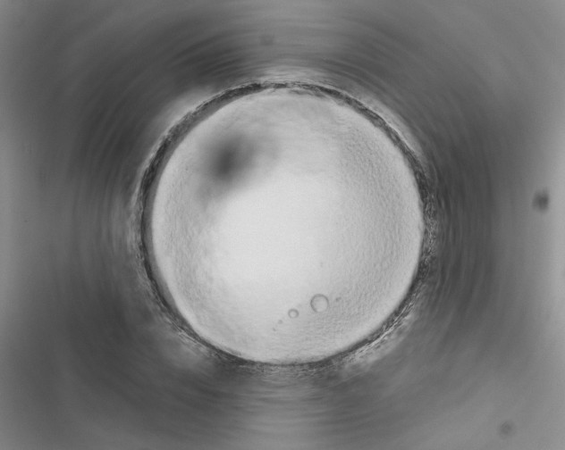 X0000116560832201001211221