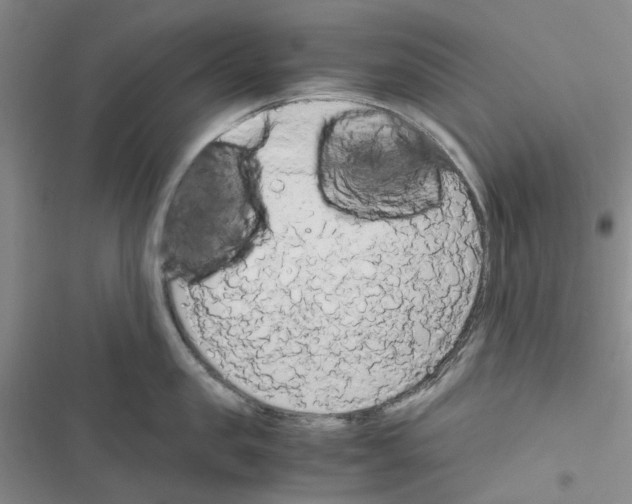 X0000116560957201001211220