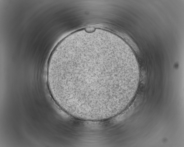X0000116561036201001211218