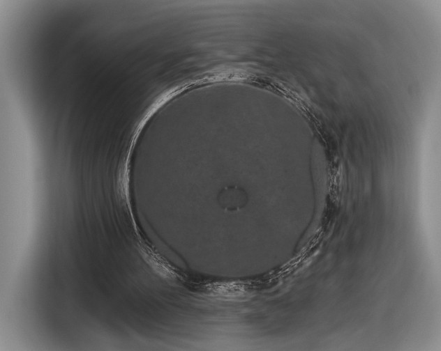 X0000116570100200912171512