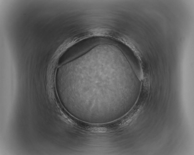 X0000116570577200912171505