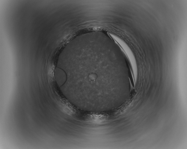 X0000116570650200912171505