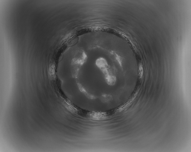 X0000116570670200912171505