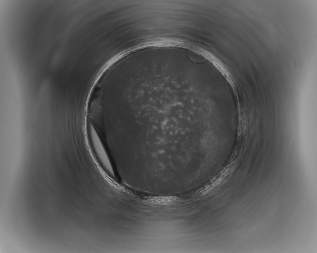 X0000116570853200912171502