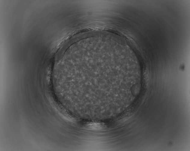 X0000116570499200912311956