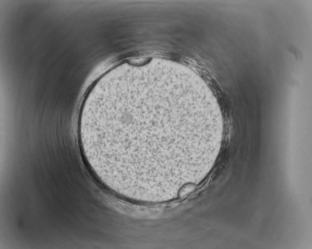 X0000116570004201001071203