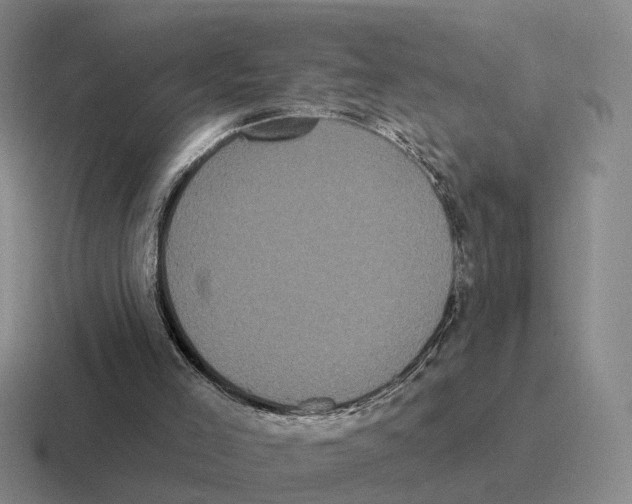 X0000116570005201001071203