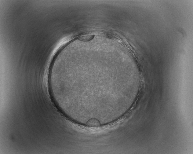 X0000116570006201001071203