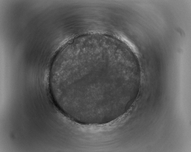 X0000116570009201001071203