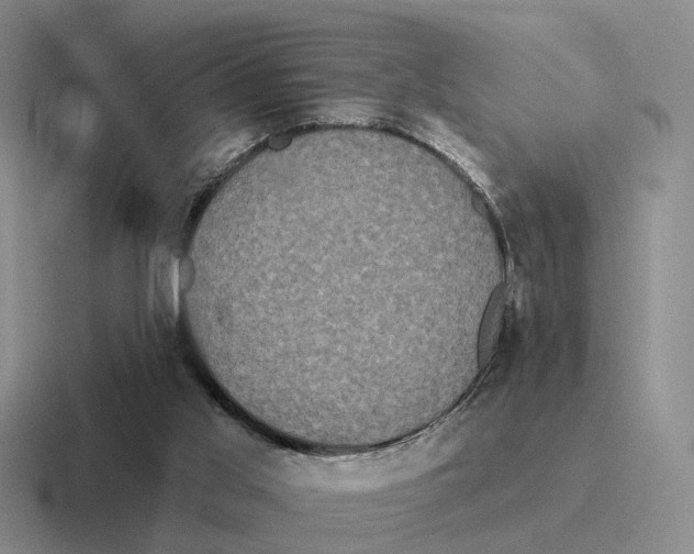 X0000116570013201001071203