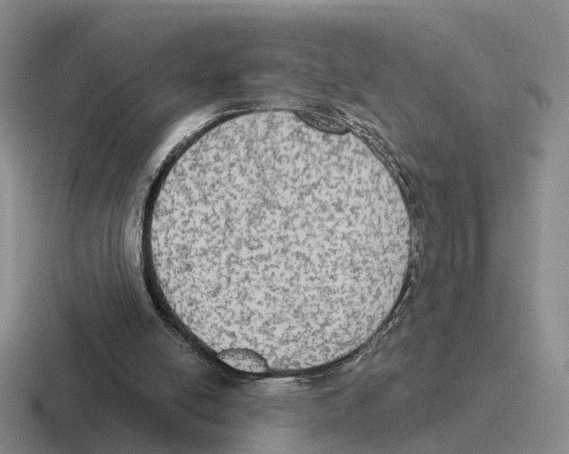 X0000116570054201001071202