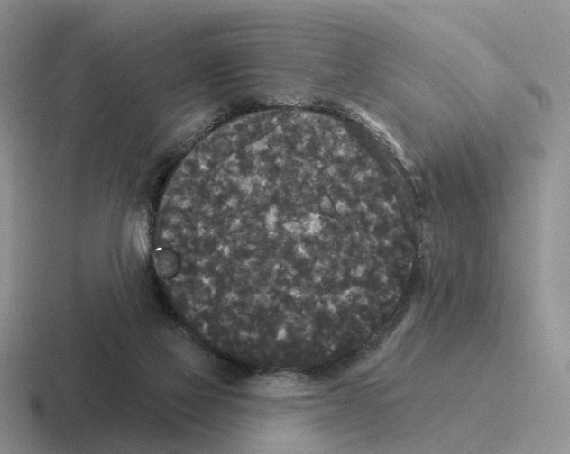 X0000116570069201001071203