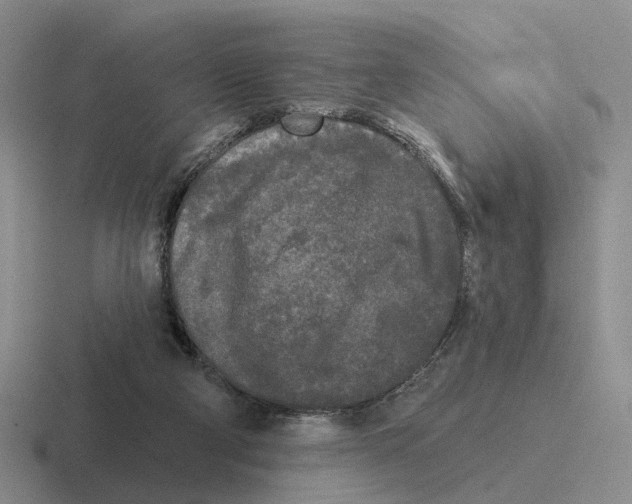 X0000116570114201001071202