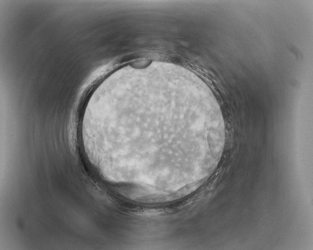 X0000116570149201001071201