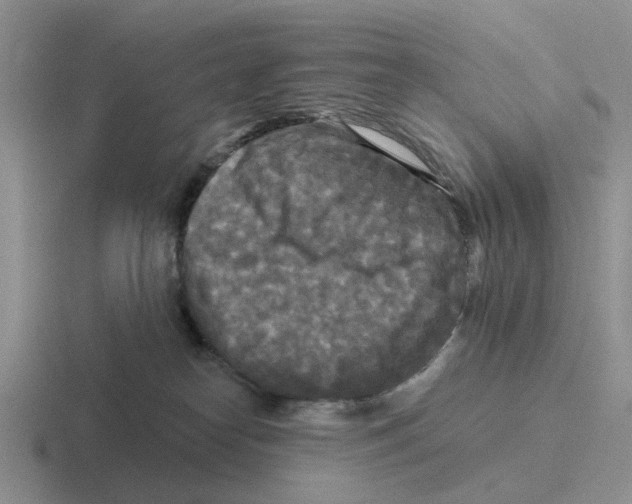 X0000116570182201001071202