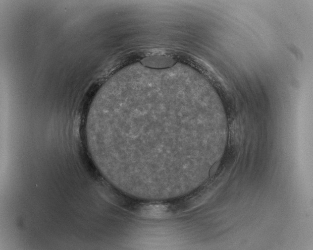 X0000116570217201001071201