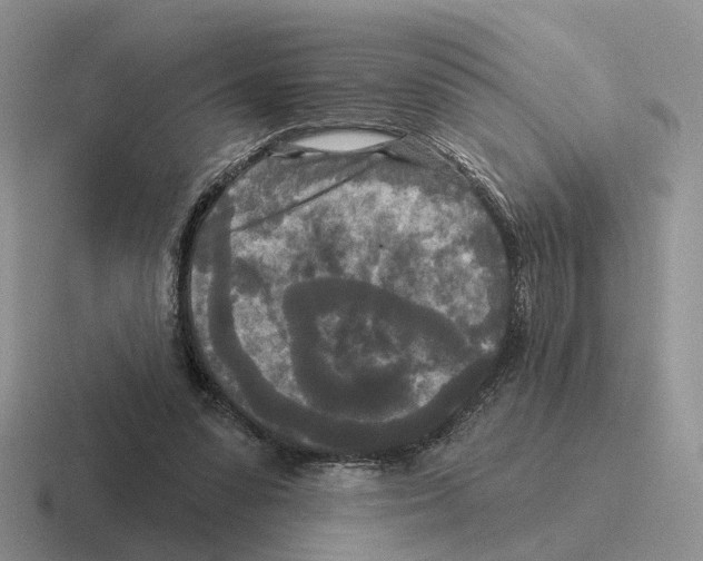 X0000116570303201001071200