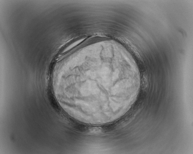 X0000116570355201001071159