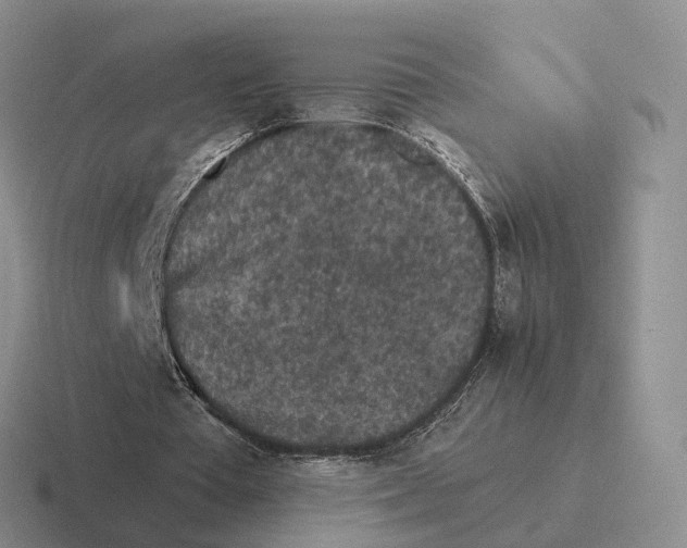 X0000116570385201001071159