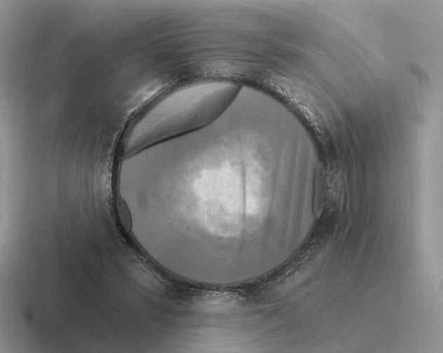 X0000116570399201001071158