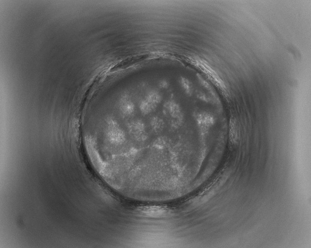 X0000116570449201001071158