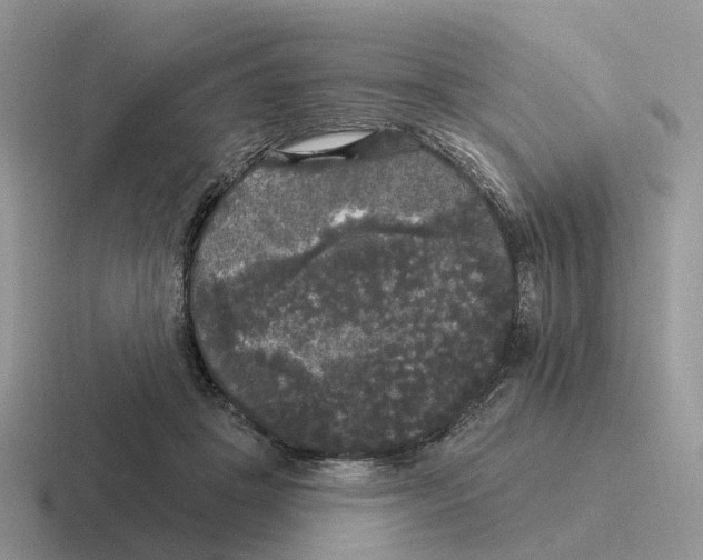 X0000116570457201001071158