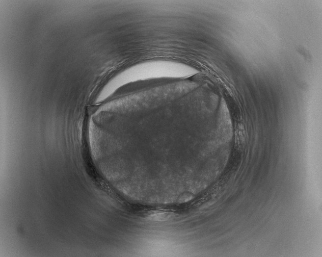 X0000116570504201001071157