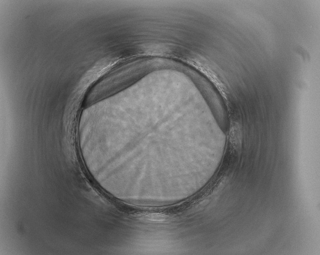 X0000116570577201001071156