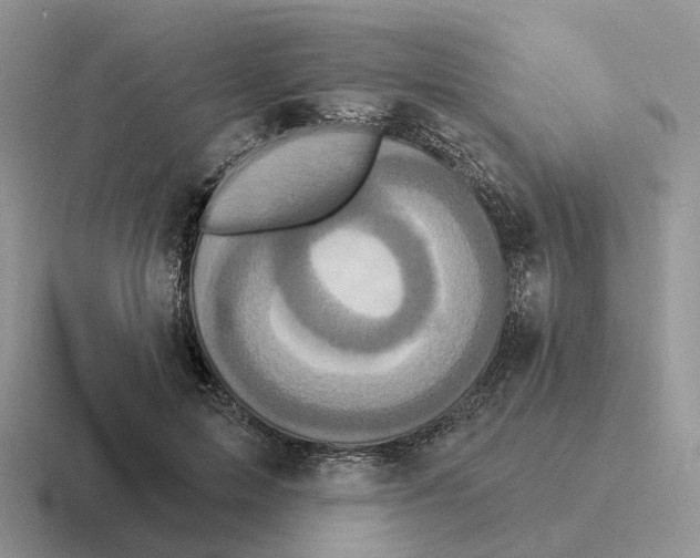 X0000116570599201001071156