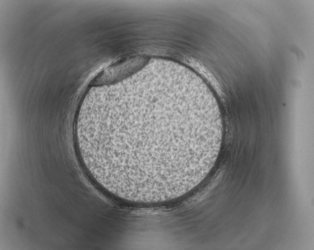 X0000116570625201001071155