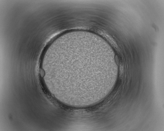 X0000116570628201001071155