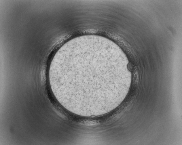 X0000116570638201001071155