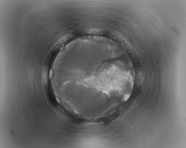 X0000116570644201001071155