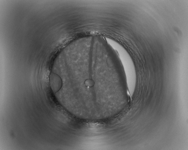 X0000116570650201001071155