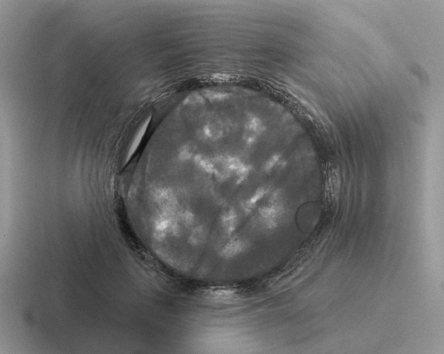 X0000116570651201001071155